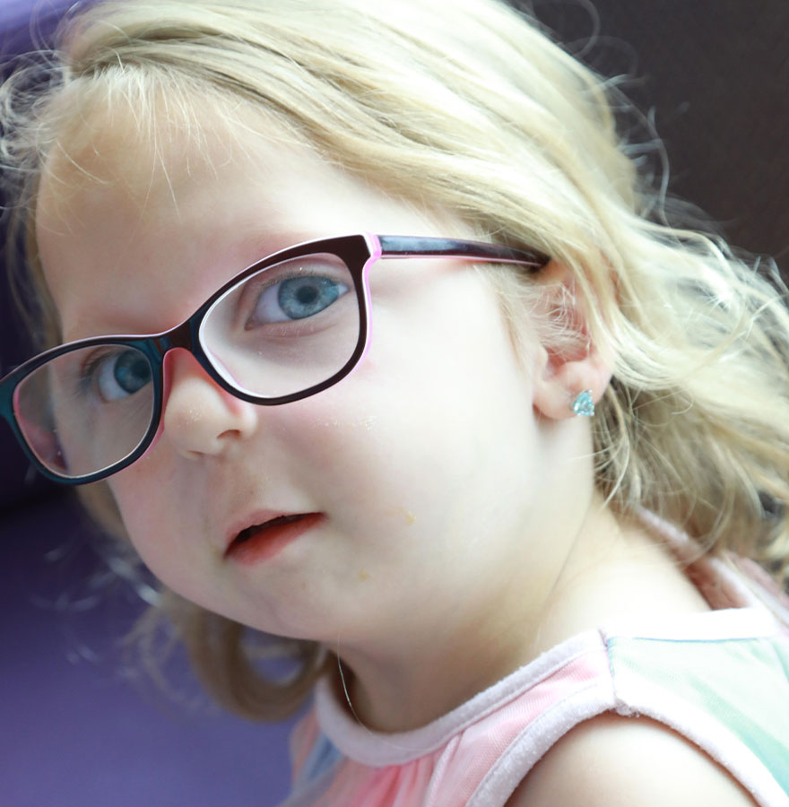 Young girl with glasses, cleft palate.