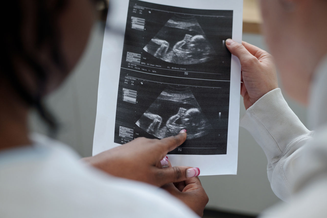 Two individuals examining an ultrasound.