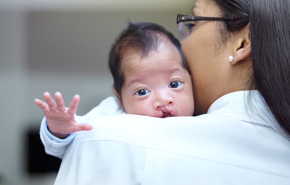 Cleft lip baby and doctor.